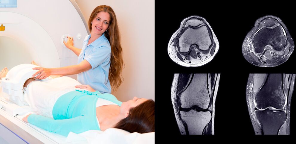 diagnostika kolenního kloubu