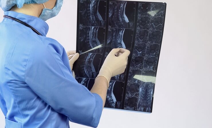 Diagnóza „cervikální osteochondrózy se provádí na základě studie MRI